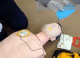 AED電極パッドの貼り付け写真